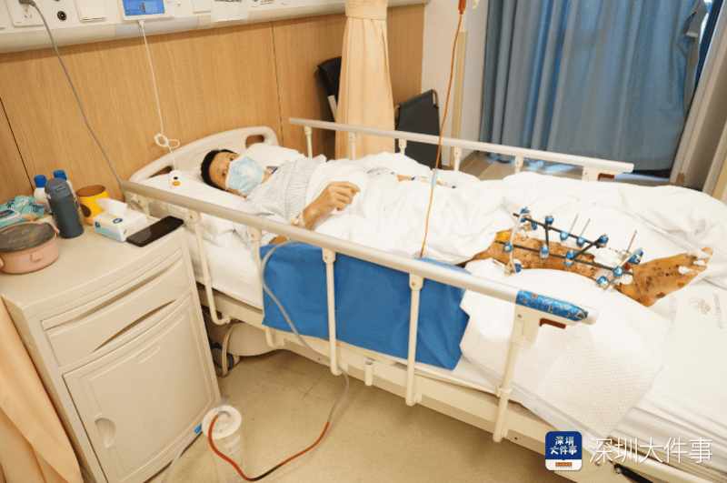 失血过半！深圳男子被三四百斤模具砸到<strong></p>
<p>SATOX</strong>，医生全力抢救