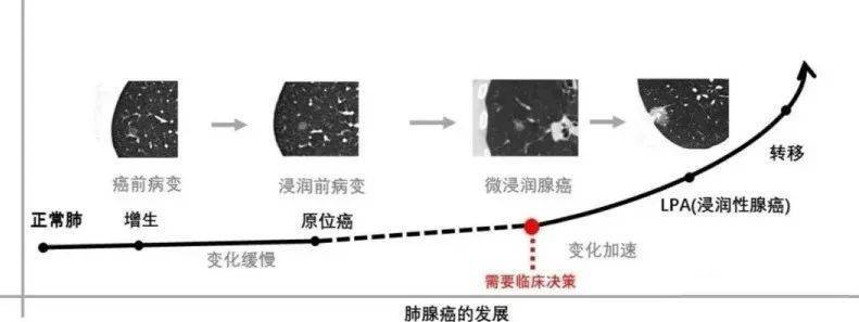 “魔术师”刘谦宣布抗癌成功<strong></p>
<p>SATOX</strong>，他的这个抗癌经验值得我们借鉴！