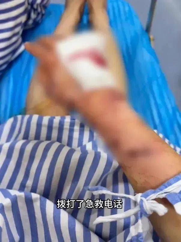 洗澡时突然爆炸<strong></p>
<p>合约</strong>，女子手筋断裂，多处缝针……家里有它快自查