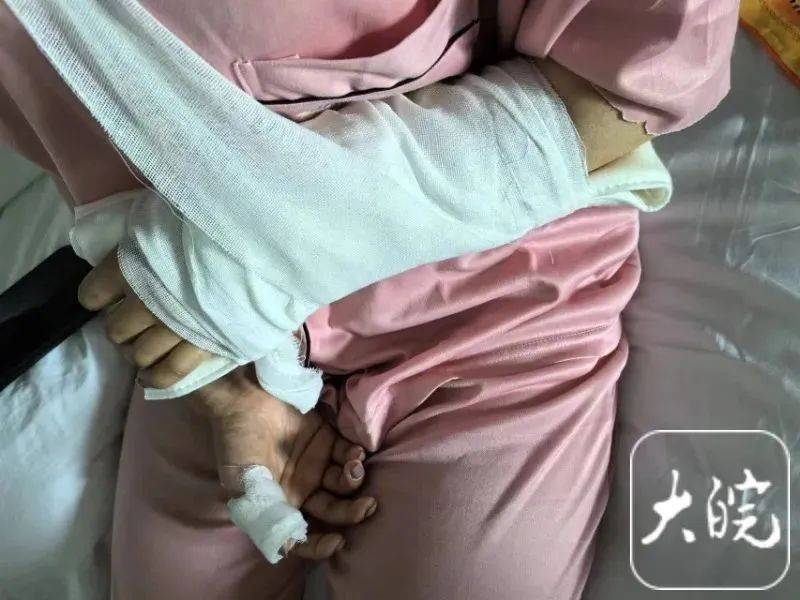 洗澡时突然爆炸<strong></p>
<p>合约</strong>，女子手筋断裂，多处缝针……家里有它快自查