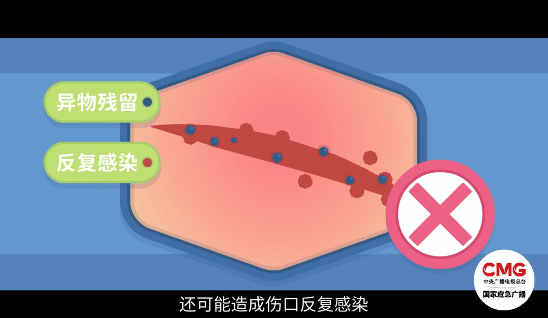 洗澡时突然爆炸<strong></p>
<p>合约</strong>，女子手筋断裂，多处缝针……家里有它快自查