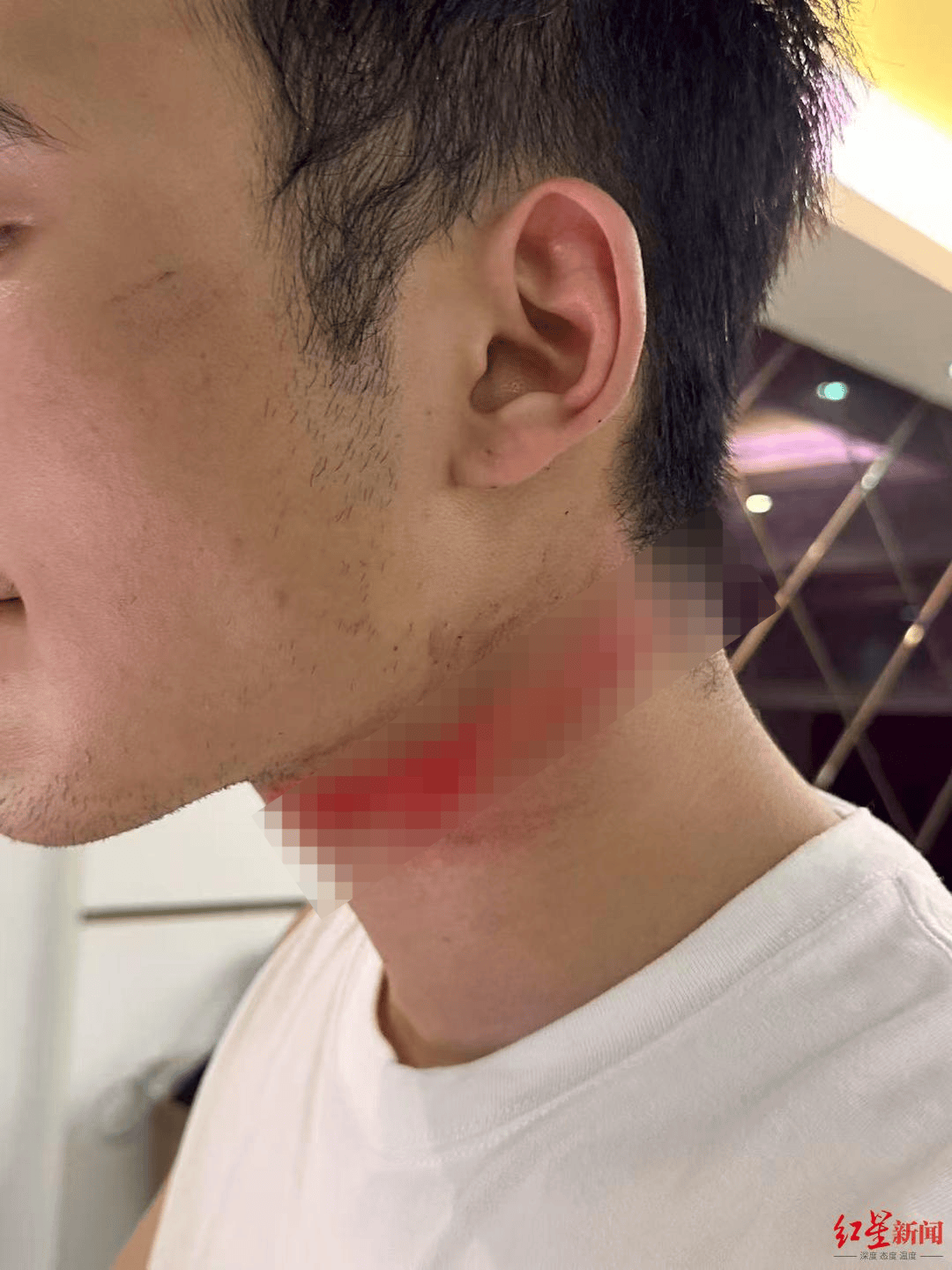 男主播骑车载女友回家被路边掉落网线勒伤脖子<strong></p>
<p>dog价格今日行情okex</strong>，索赔3万陷僵局 律师解读该谁赔
